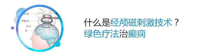 经颅磁刺激治疗癫痫