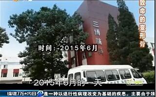 致命的“变形骨”（颈椎病）<