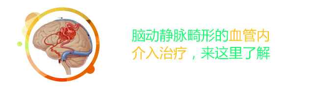 脑动静脉畸形的介入治疗
