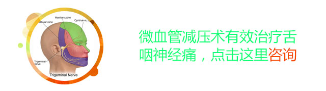 舌咽神经痛的药物治疗