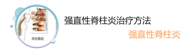 治强直脊柱炎的方法
