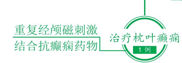 重复经颅磁刺激 结合抗癫痫药物