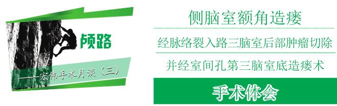 侧脑室额角造瘘经脉络裂入路三脑室后部肿瘤切除并经室间孔第三脑室底造瘘术