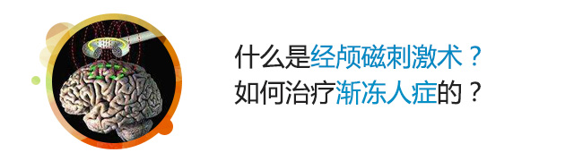 经颅磁刺激术如何治疗渐冻人症？