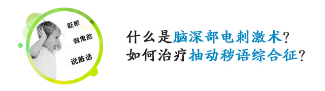 脑深部电刺激术（DBS）治疗抽动秽语综合征
