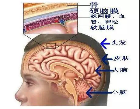 脑膜瘤主要长在蛛网膜上 脑膜瘤主要长在蛛网膜上