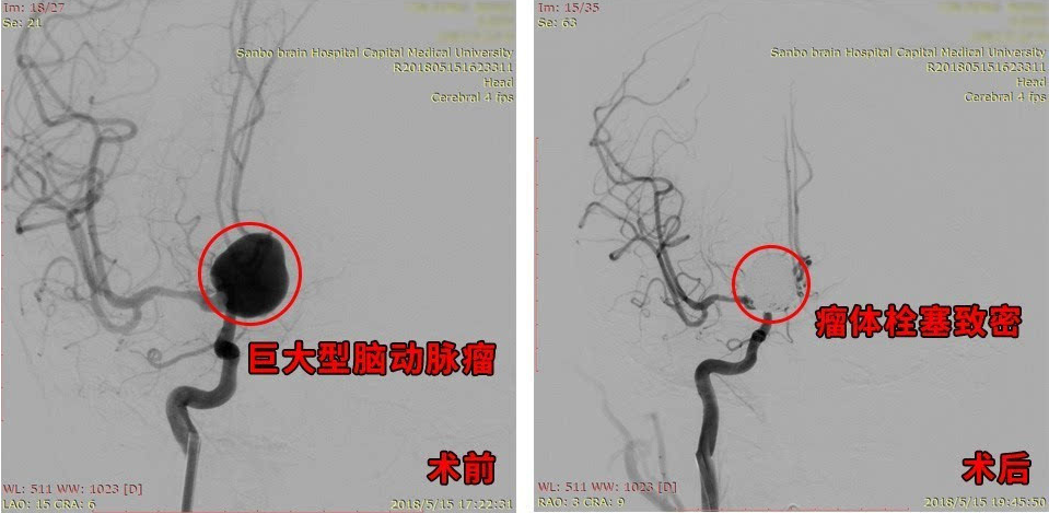 QQ截图20181010153816.png