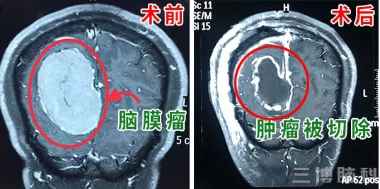 QQ截图20181120165643.png
