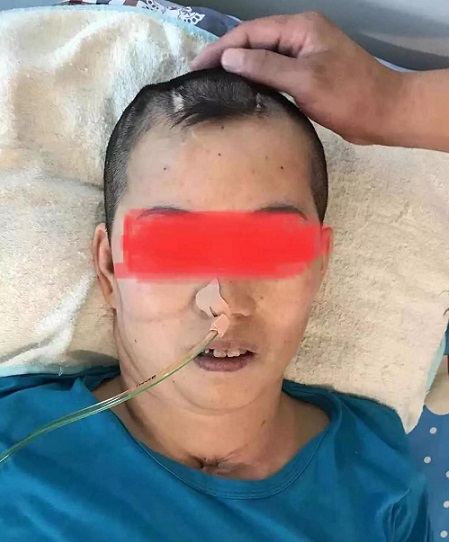 在家里如何长期护理昏迷患者？有哪些注意事项？